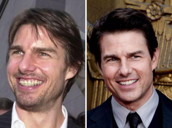Tom Cruise tökéletes mosolya